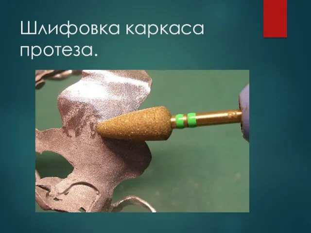 Шлифовка каркаса протеза.