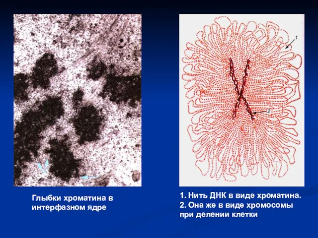 Глыбки хроматина в интерфазном ядре 1. Нить ДНК в виде