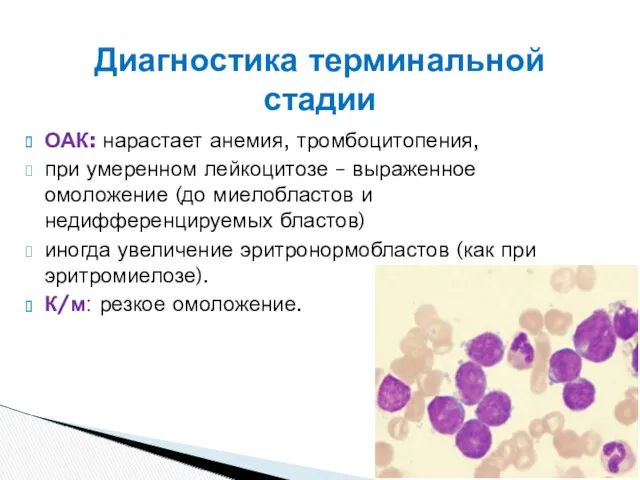 ОАК: нарастает анемия, тромбоцитопения, при умеренном лейкоцитозе – выраженное омоложение