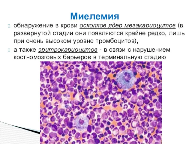 обнаружение в крови осколков ядер мегакариоцитов (в развернутой стадии они