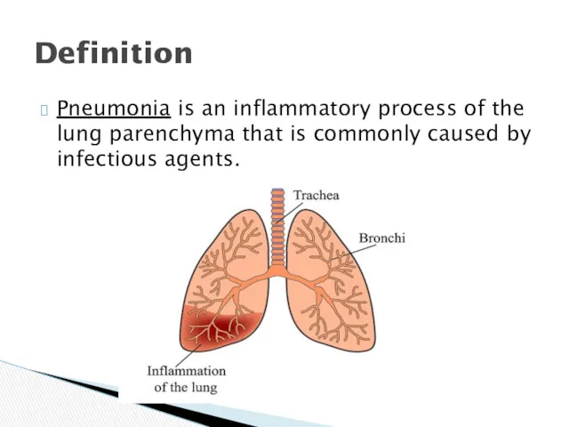 Pneumonia is an inflammatory process of the lung parenchyma that