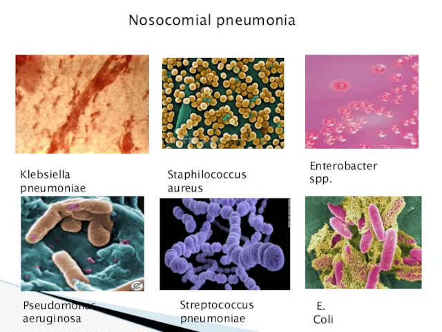 Nosocomial pneumonia Klebsiella pneumoniae Enterobacter spp. Staphilococcus aureus Pseudomonas aeruginosa E. Coli Streptococcus pneumoniae