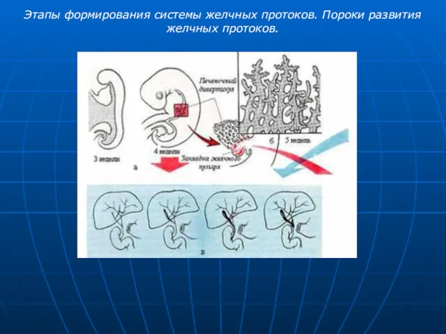 Этапы формирования системы желчных протоков. Пороки развития желчных протоков.