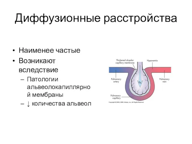 Диффузионные расстройства Наименее частые Возникают вследствие Патологии альвеолокапиллярной мембраны ↓ количества альвеол