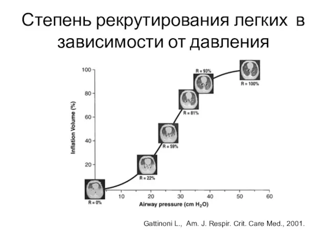 Степень рекрутирования легких в зависимости от давления Gattinoni L., Am. J. Respir. Crit. Care Med., 2001.