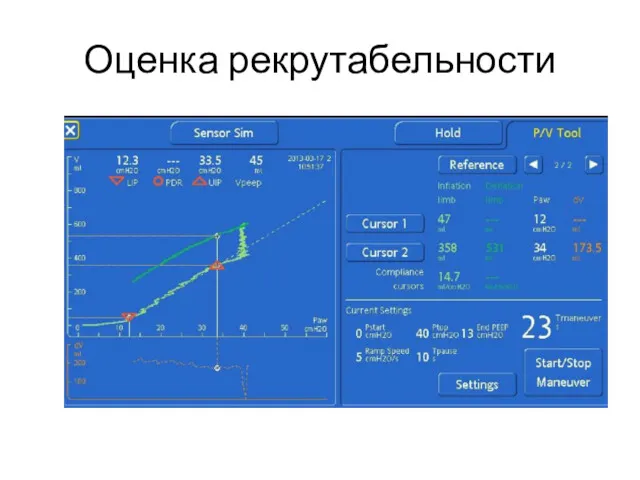 Оценка рекрутабельности