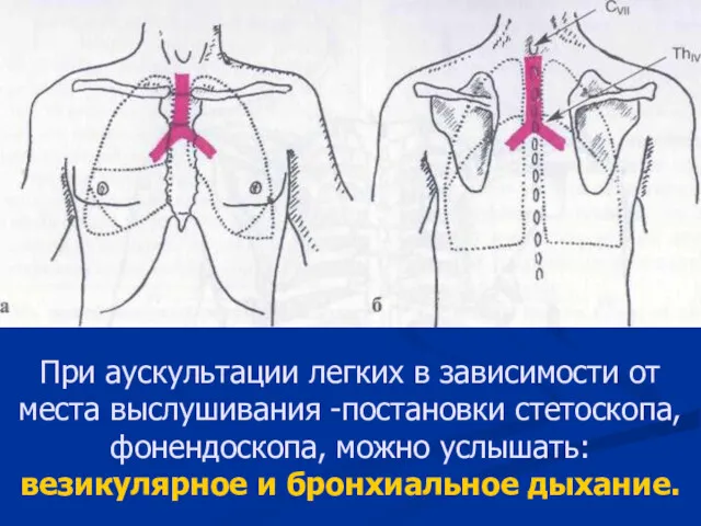 При аускультации легких в зависимости от места выслушивания -постановки стетоскопа,