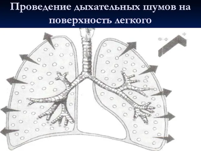 Проведение дыхательных шумов на поверхность легкого