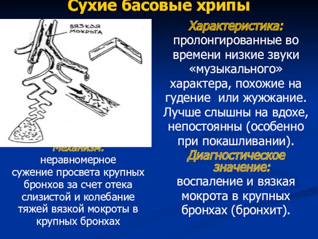 Сухие басовые хрипы Механизм: неравномерное сужение просвета крупных бронхов за