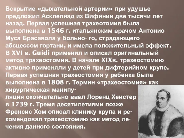 Вскрытие «дыхательной артерии» при удушье предложил Асклепиад из Вифинии две