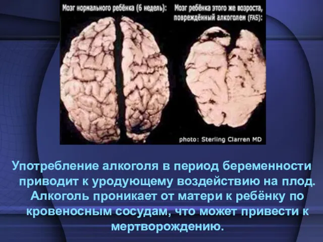 Употребление алкоголя в период беременности приводит к уродующему воздействию на плод. Алкоголь проникает