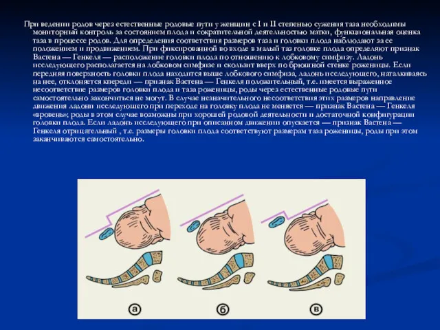 При ведении родов через естественные родовые пути у женщин с I и II