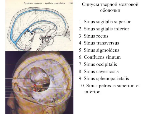 Синусы твердой мозговой оболочки 1. Sinus sagitalis superior 2. Sinus