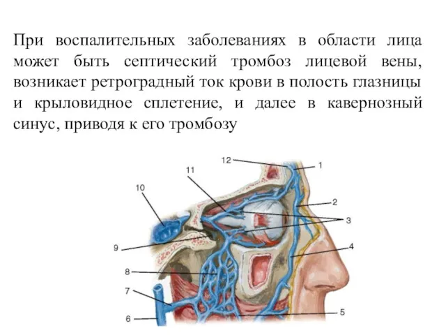 При воспалительных заболеваниях в области лица может быть септический тромбоз
