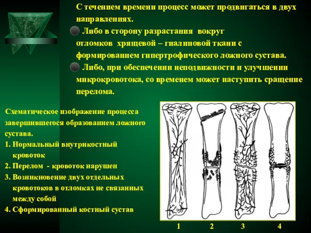 С течением времени процесс может продвигаться в двух направлениях. ⚫