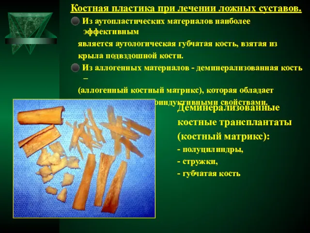 Костная пластика при лечении ложных суставов. ⚫ Из аутопластических материалов