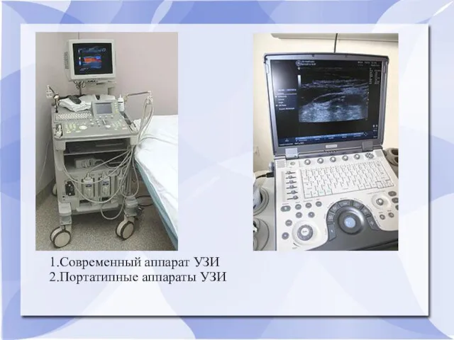 1.Современный аппарат УЗИ 2.Портатипные аппараты УЗИ