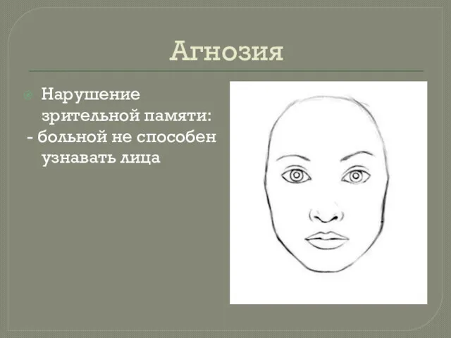 Агнозия Нарушение зрительной памяти: - больной не способен узнавать лица