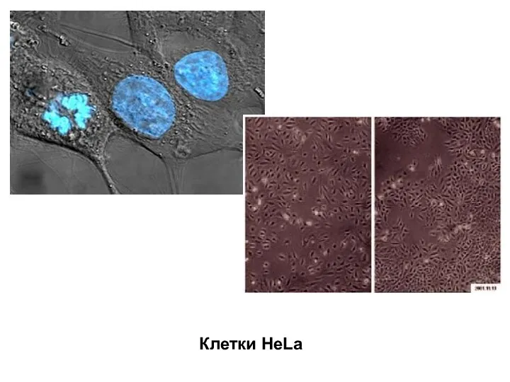 Клетки HeLa