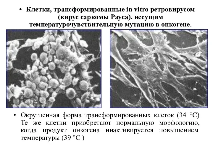 Клетки, трансформированные in vitro ретровирусом (вирус саркомы Рауса), несущим температурочувствительную