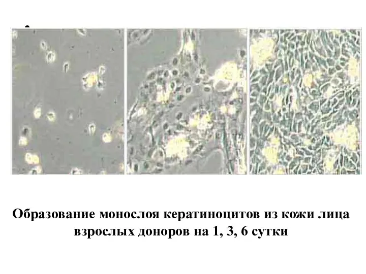 Образование монослоя кератиноцитов из кожи лица взрослых доноров на 1, 3, 6 сутки