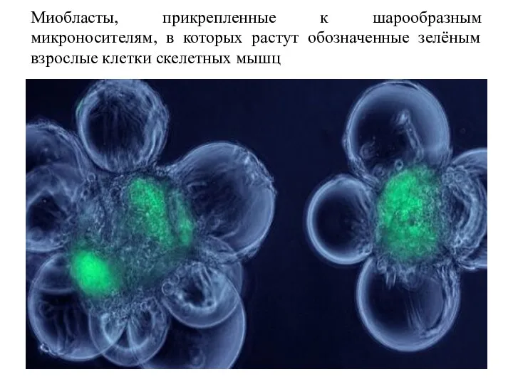 Миобласты, прикрепленные к шарообразным микроносителям, в которых растут обозначенные зелёным взрослые клетки скелетных мышц