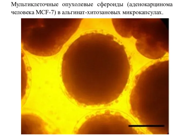 Мультиклеточные опухолевые сфероиды (аденокарцинома человека MCF-7) в альгинат-хитозановых микрокапсулах.