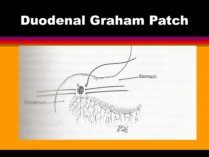Duodenal Graham Patch