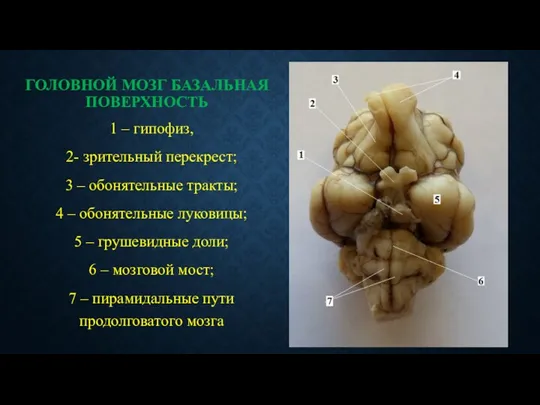 ГОЛОВНОЙ МОЗГ БАЗАЛЬНАЯ ПОВЕРХНОСТЬ 1 – гипофиз, 2- зрительный перекрест;