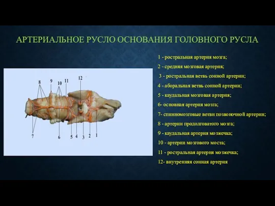 АРТЕРИАЛЬНОЕ РУСЛО ОСНОВАНИЯ ГОЛОВНОГО РУСЛА 1 - ростральная артерия мозга;