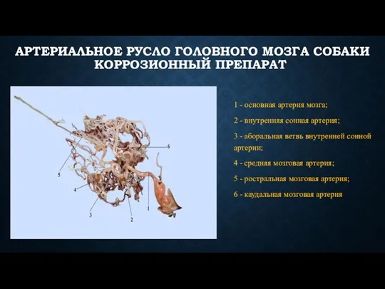 АРТЕРИАЛЬНОЕ РУСЛО ГОЛОВНОГО МОЗГА СОБАКИ КОРРОЗИОННЫЙ ПРЕПАРАТ 1 - основная