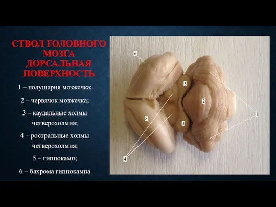 СТВОЛ ГОЛОВНОГО МОЗГА ДОРСАЛЬНАЯ ПОВЕРХНОСТЬ 1 – полушария мозжечка; 2