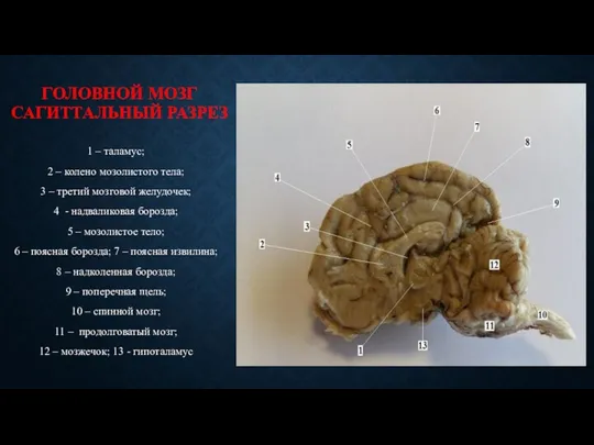 ГОЛОВНОЙ МОЗГ САГИТТАЛЬНЫЙ РАЗРЕЗ 1 – таламус; 2 – колено