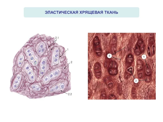 ЭЛАСТИЧЕСКАЯ ХРЯЩЕВАЯ ТКАНЬ