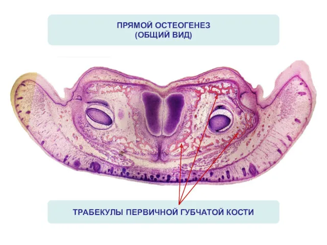 ПРЯМОЙ ОСТЕОГЕНЕЗ (ОБЩИЙ ВИД) ТРАБЕКУЛЫ ПЕРВИЧНОЙ ГУБЧАТОЙ КОСТИ