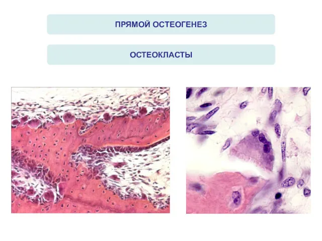 ПРЯМОЙ ОСТЕОГЕНЕЗ ОСТЕОКЛАСТЫ