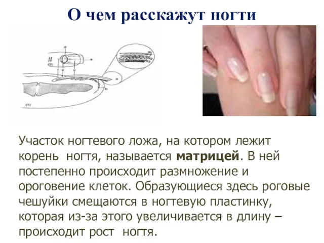 О чем расскажут ногти Участок ногтевого ложа, на котором лежит