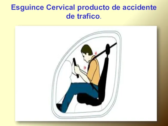 Esguince Cervical producto de accidente de trafico.