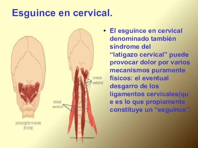 Esguince en cervical. El esguince en cervical denominado también síndrome