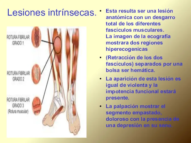 Lesiones intrínsecas. Esta resulta ser una lesión anatómica con un