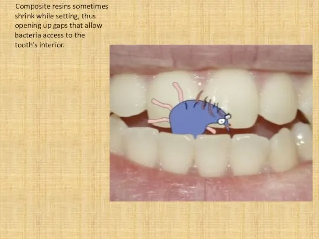 Composite resins sometimes shrink while setting, thus opening up gaps