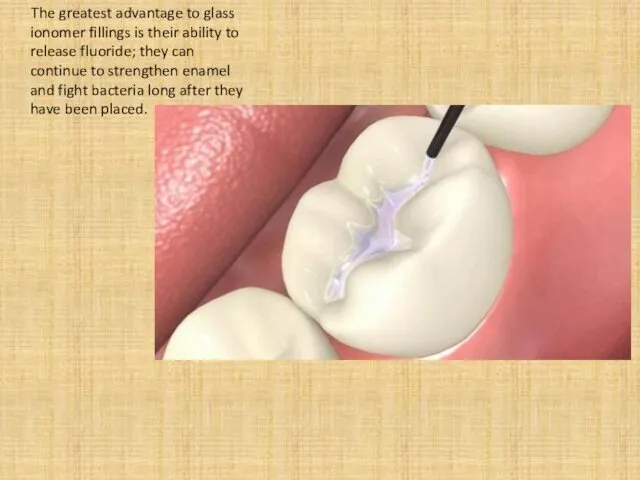 The greatest advantage to glass ionomer fillings is their ability