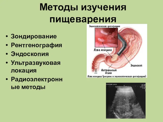 Методы изучения пищеварения Зондирование Рентгенография Эндоскопия Ультразвуковая локация Радиоэлектронные методы