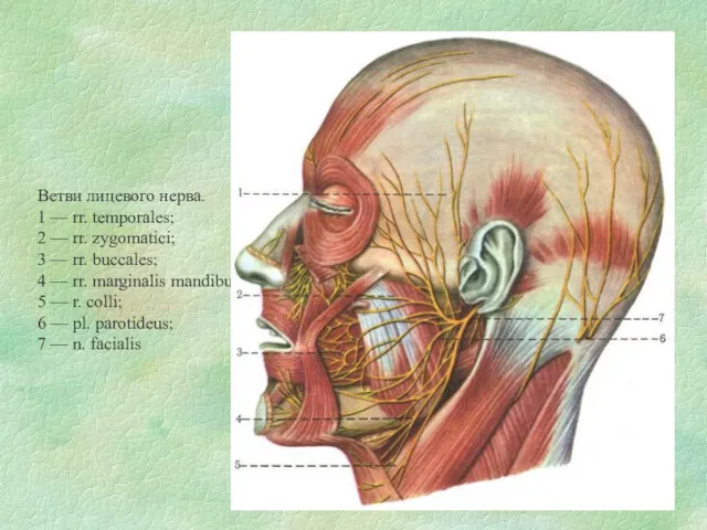 Ветви лицевого нерва. 1 — rr. temporales; 2 — rr. zygomatici; 3 —