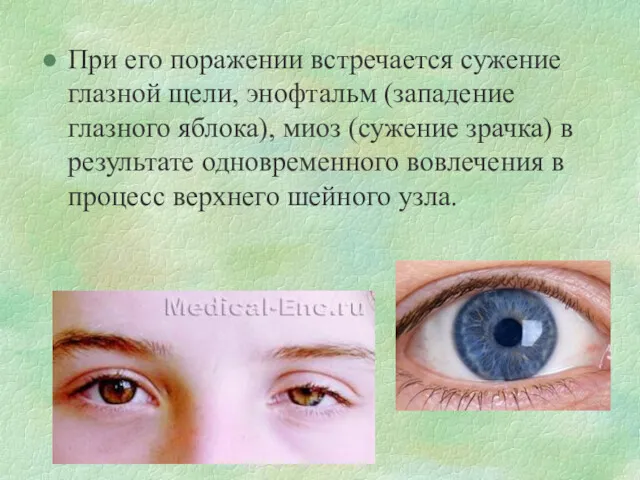 При его поражении встречается сужение глазной щели, энофтальм (западение глазного яблока), миоз (сужение