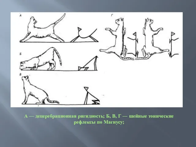 А — децеребрационная ригидность; Б, В, Г — шейные тонические рефлексы по Магнусу;