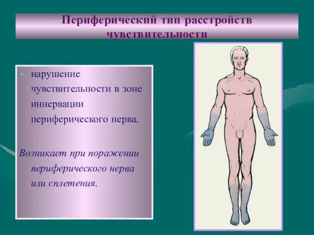 Периферический тип расстройств чувствительности нарушение чувствительности в зоне иннервации периферического