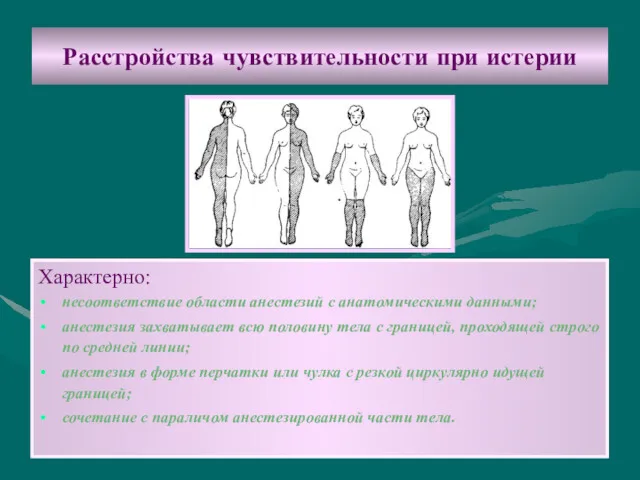 Расстройства чувствительности при истерии Характерно: несоответствие области анестезий с анатомическими