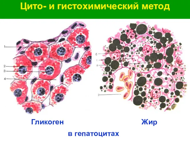 Цито- и гистохимический метод Гликоген Жир в гепатоцитах
