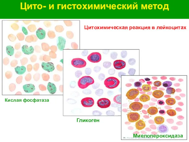 Цито- и гистохимический метод Цитохимическая реакция в лейкоцитах Кислая фосфатаза Гликоген Миелопероксидаза